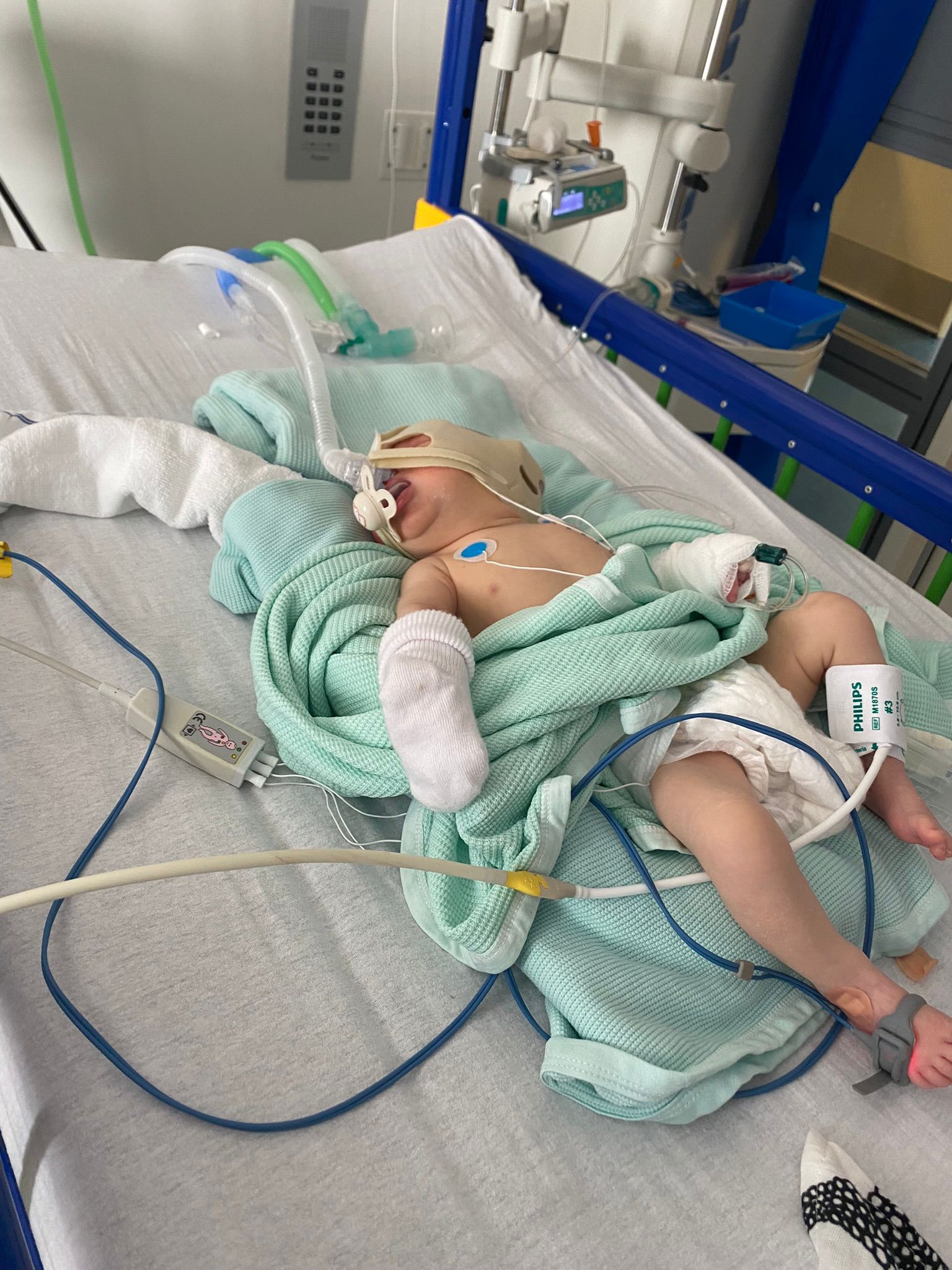 Jackson in hospital after birth